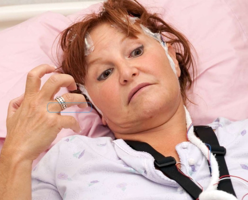 سکته مغزی چیست؟