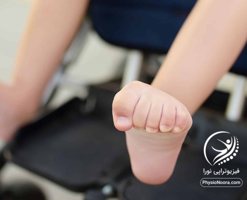 اسپاستیسیتی در ام اس